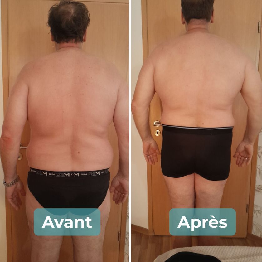 Photo avant et après un accompagnement MAbeautyplus