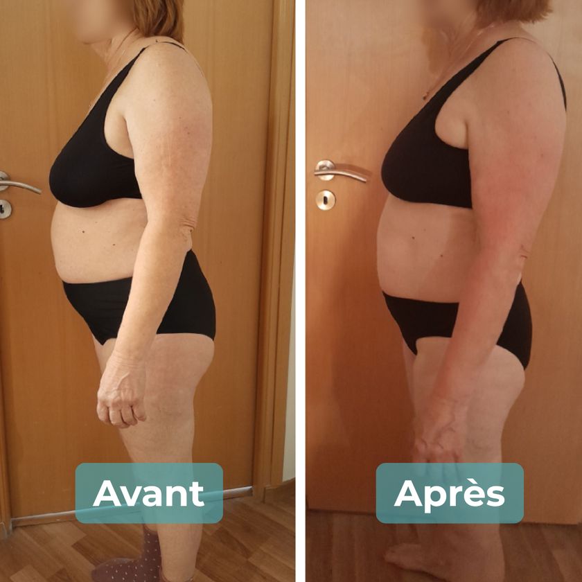 Photo avant et après un accompagnement MAbeautyplus
