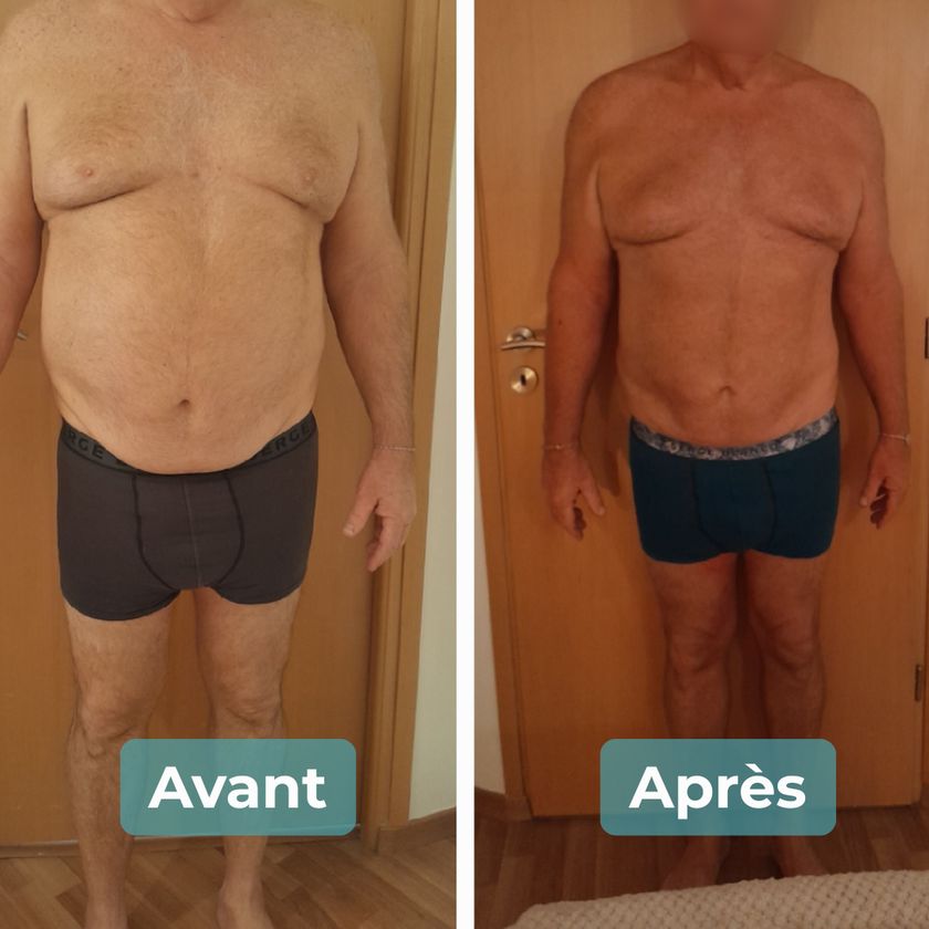 Photo avant et après un accompagnement MAbeautyplus